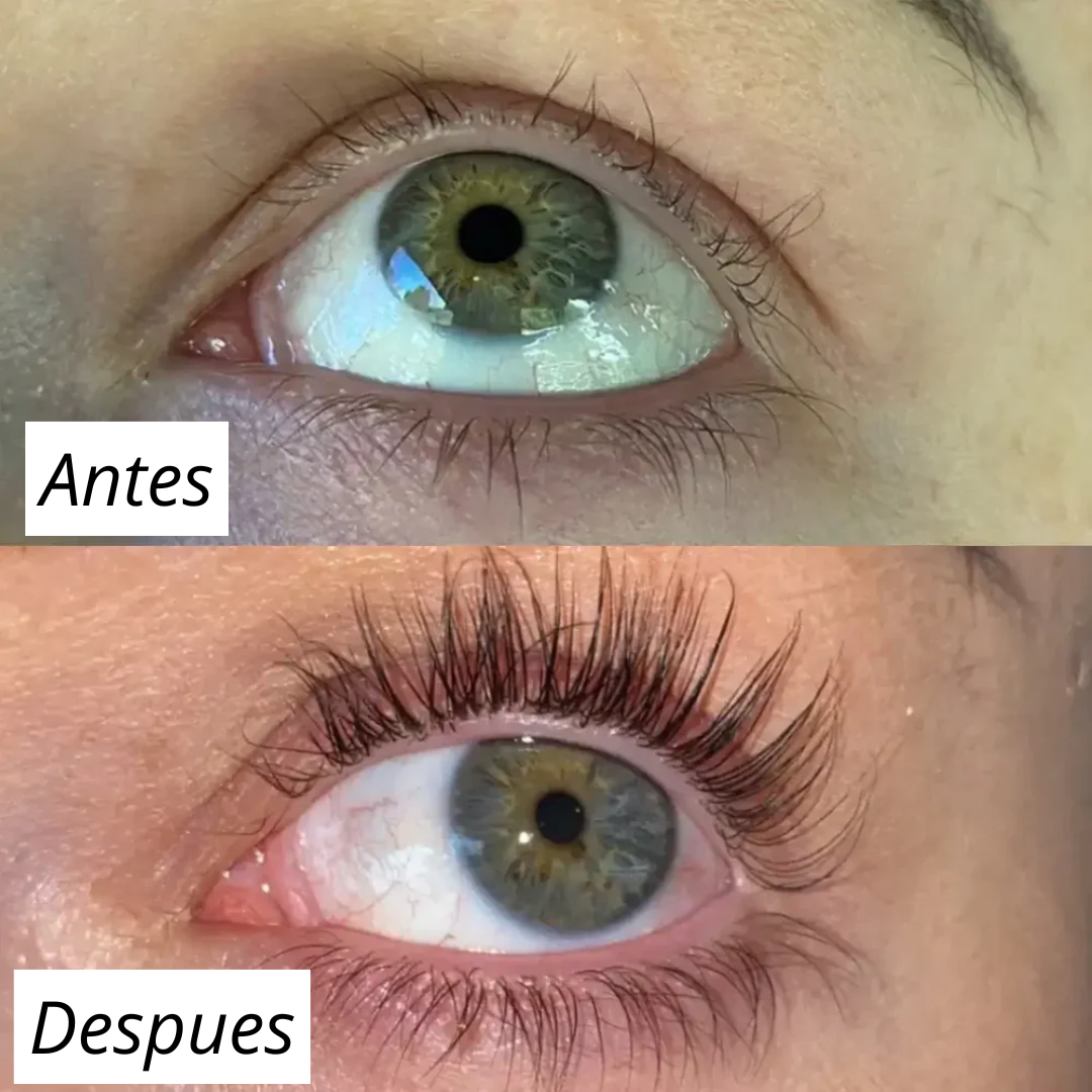 FORCHICS - Serum para crecimiento de pestañas (OFERTA 2X1)