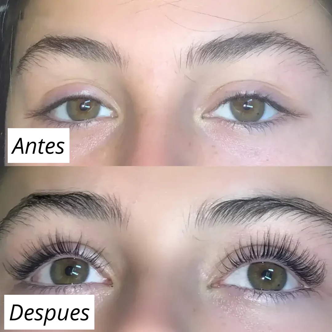 FORCHICS - Serum para crecimiento de pestañas (OFERTA 2X1)