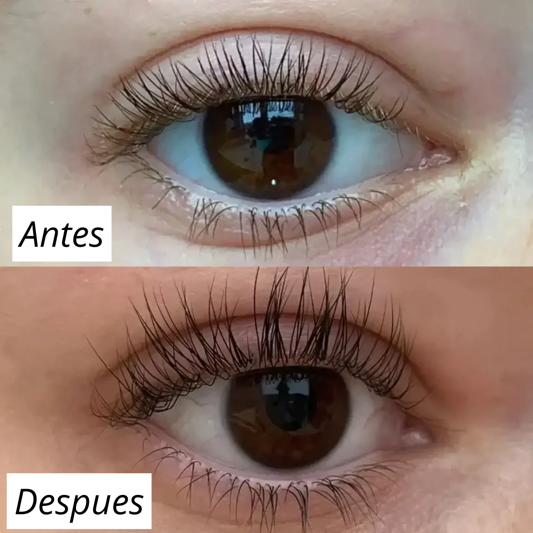 FORCHICS - Serum para crecimiento de pestañas (OFERTA 2X1)