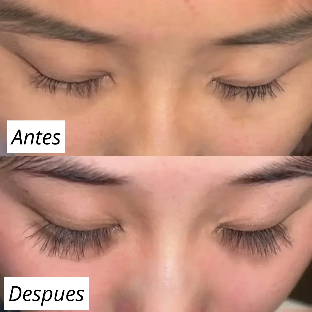 FORCHICS - Serum para crecimiento de pestañas (OFERTA 2X1)