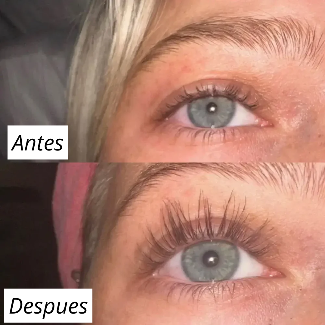 FORCHICS - Serum para crecimiento de pestañas (OFERTA 2X1)