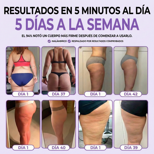 Masajeador 4 en 1 Anticelilitico by Zolara®